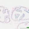 image of coagulating gland